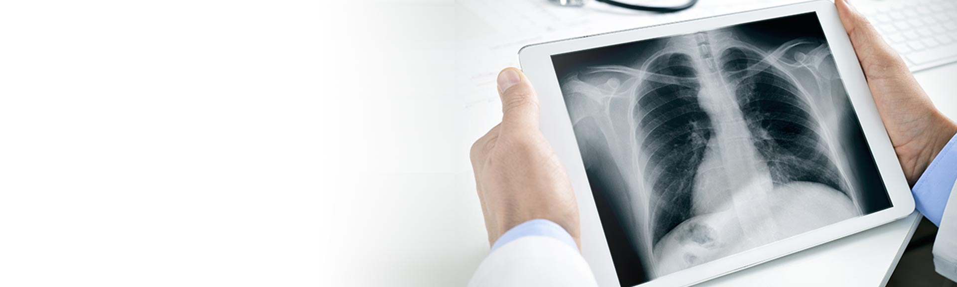 X-ray digital radiography (DR)